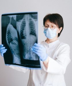 куріння і ХОЗЛ 